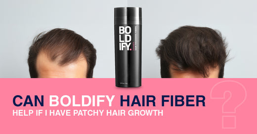 Can Boldify Hair Fiber Help If I Have Patchy Hair Growth?