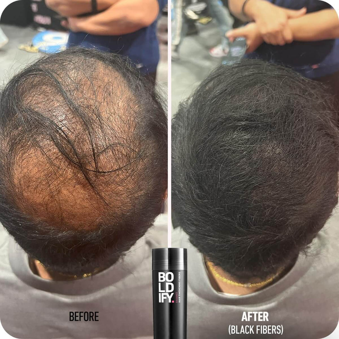 Boldify Hair Thickening Fibers 28g - Before and After Using Black Fibers