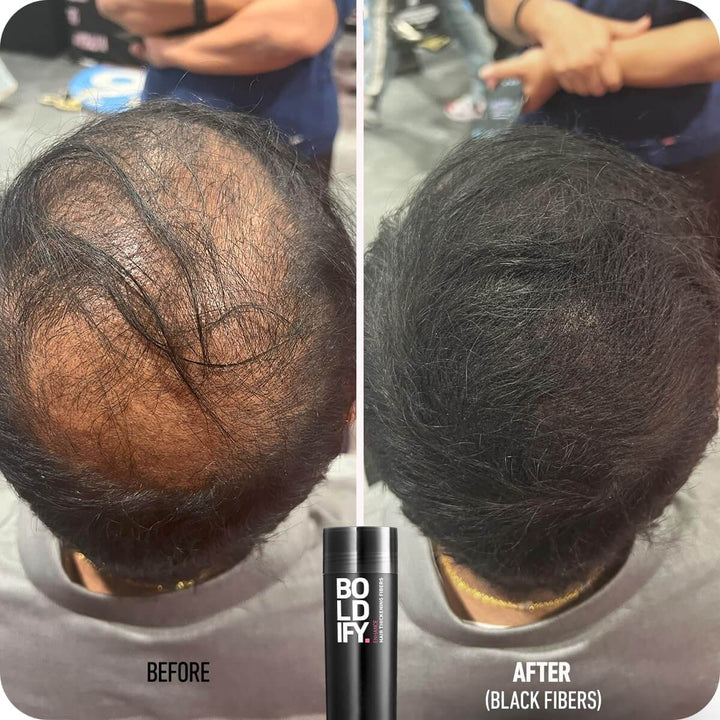 Boldify Hair Thickening Fibers 28g - Before and After Using Black Fibers